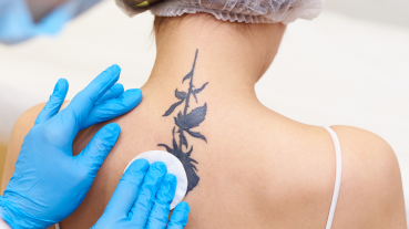 진피층 리프팅 콜라겐 생성