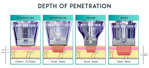스타워커 비교 이미지